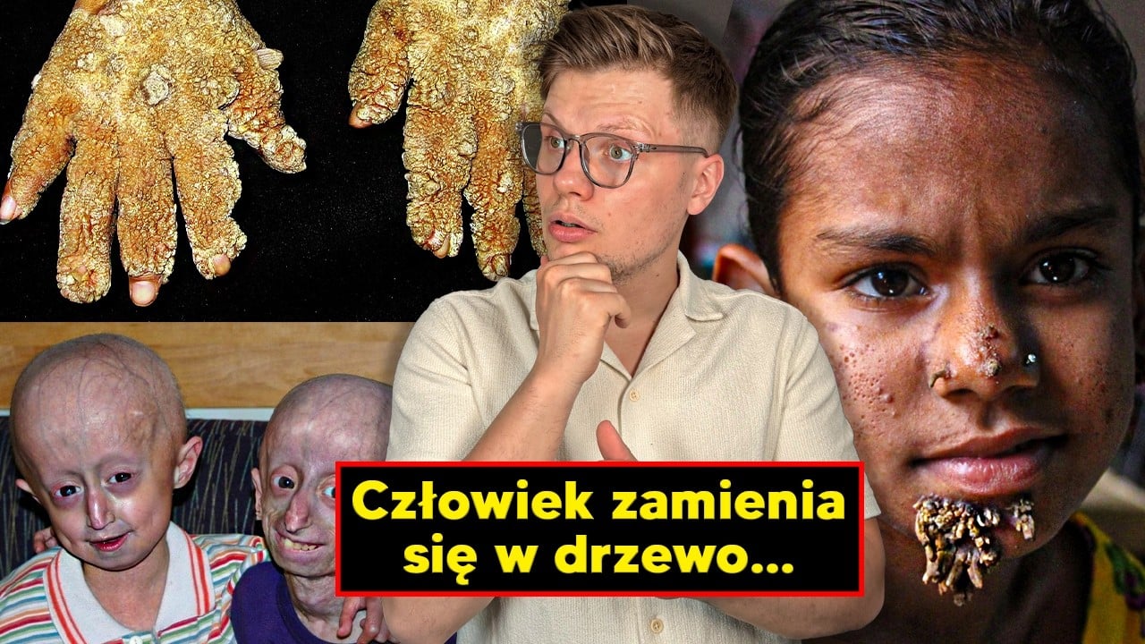 Najstraszniejsze Ludzkie MUTACJE!