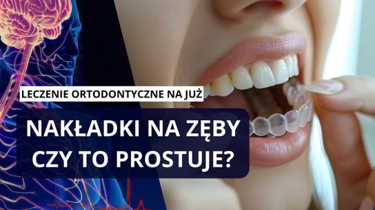 Założyłam nakładki i… moje zęby zmieniły się na dobre  Fakty i mity o nakładkowym prostowaniu zębów!