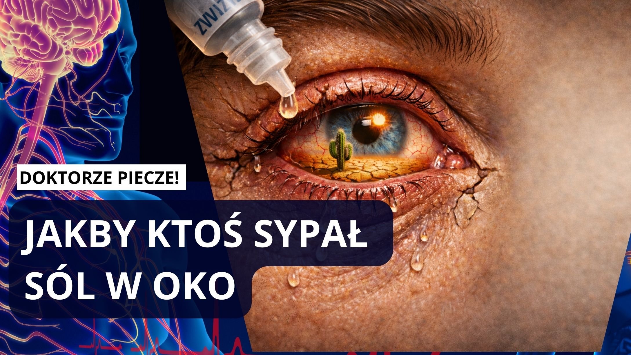 Dlaczego Twoje oczy pieką?!