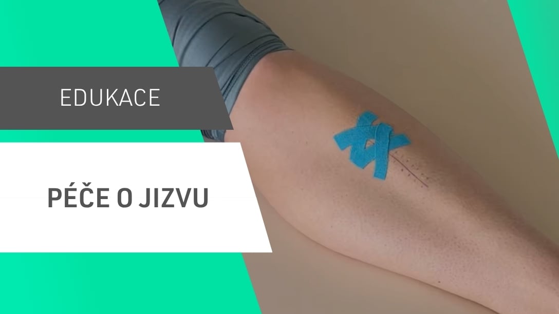 Péče o jizvu