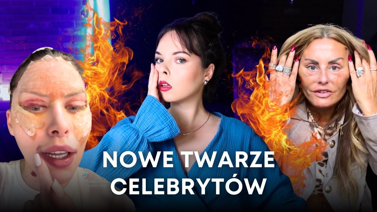 Inwazja klonów i lifting twarzy przed 30! (Julia Von Stein, Dagmara Kaźmierska i inni)
