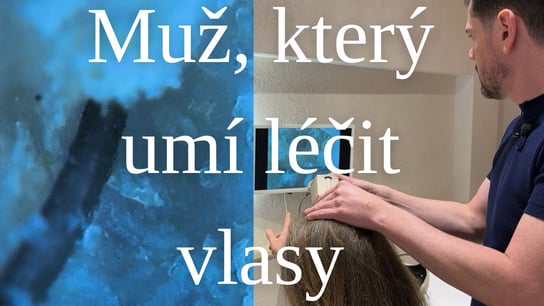 BORCI: Dermotricholog Lukáš Rossbach. Muž, který léčí vlasy a vlasovou pokožku, včetně těch nejtěžších případů ichtyózy, seborey i alopecie 