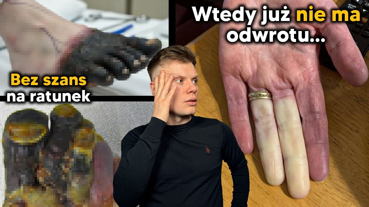 Gdy jesteś zjadany od ŚRODKA! MARTWICA tkanek i GANGRENA. Najgorsze co Cię może spotkać...