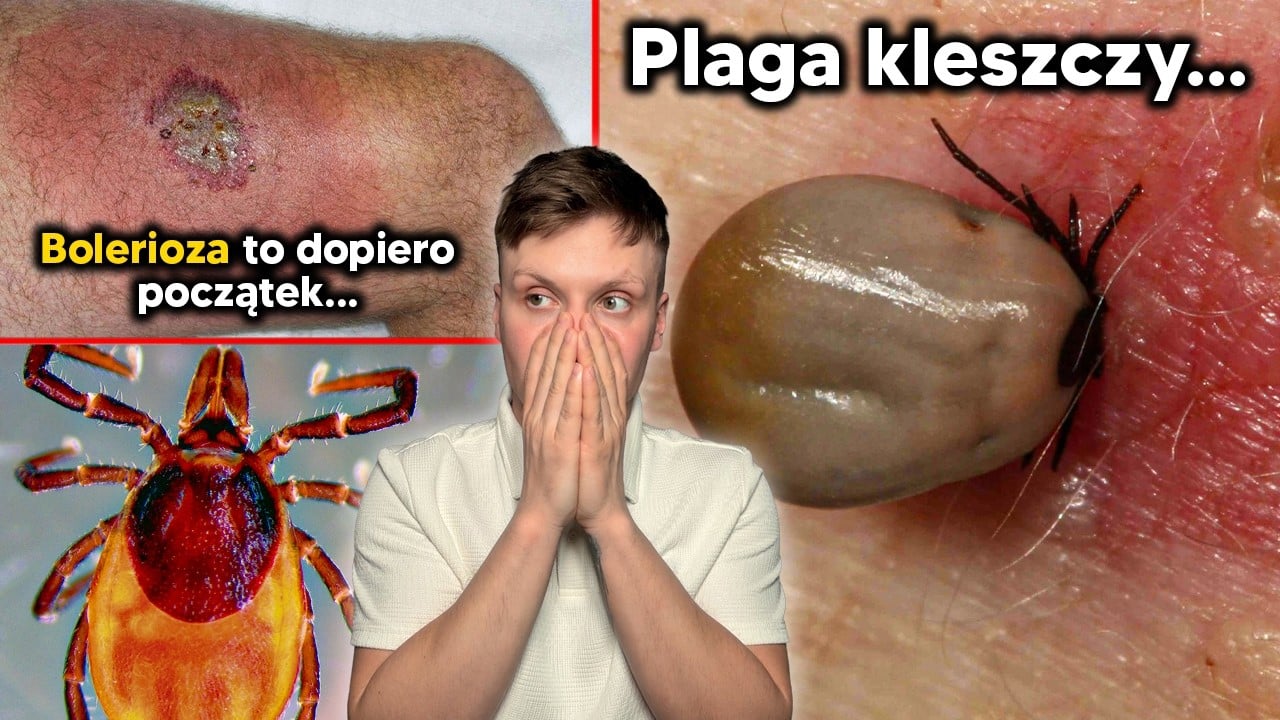 Epidemia kleszczy ZALEWA Polskę. Borelioza i kleszczowe zapalenie mózgu to dopiero początek...