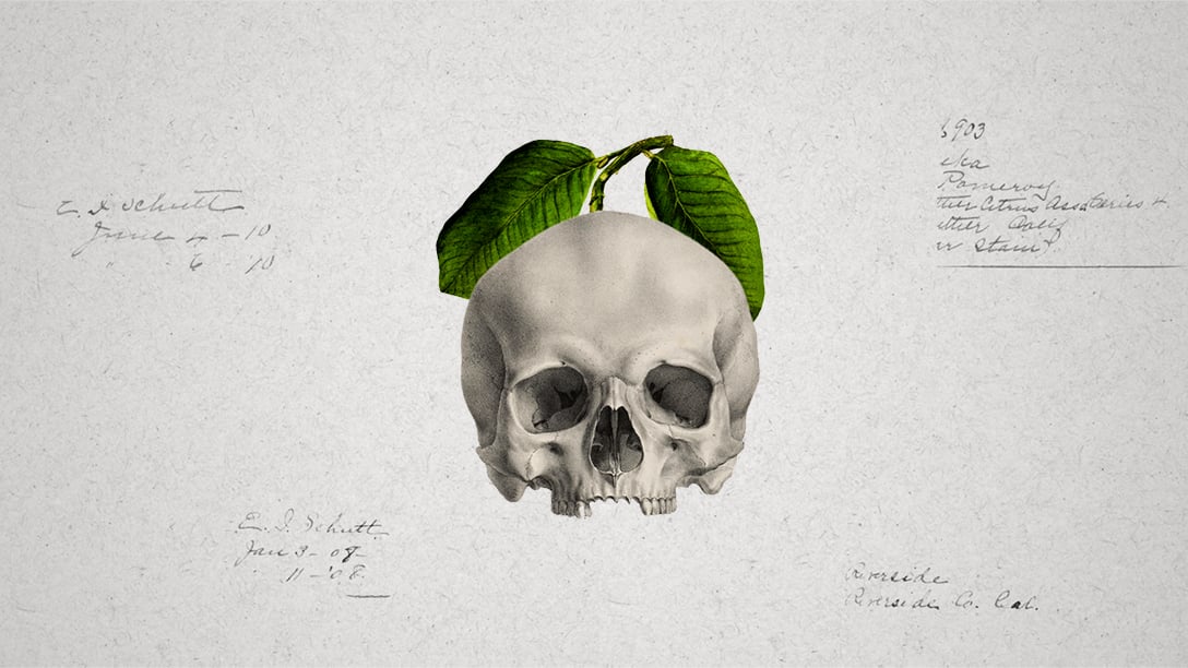 TA choroba zabiła 2 MILIONY ludzi mimo lekarstwa