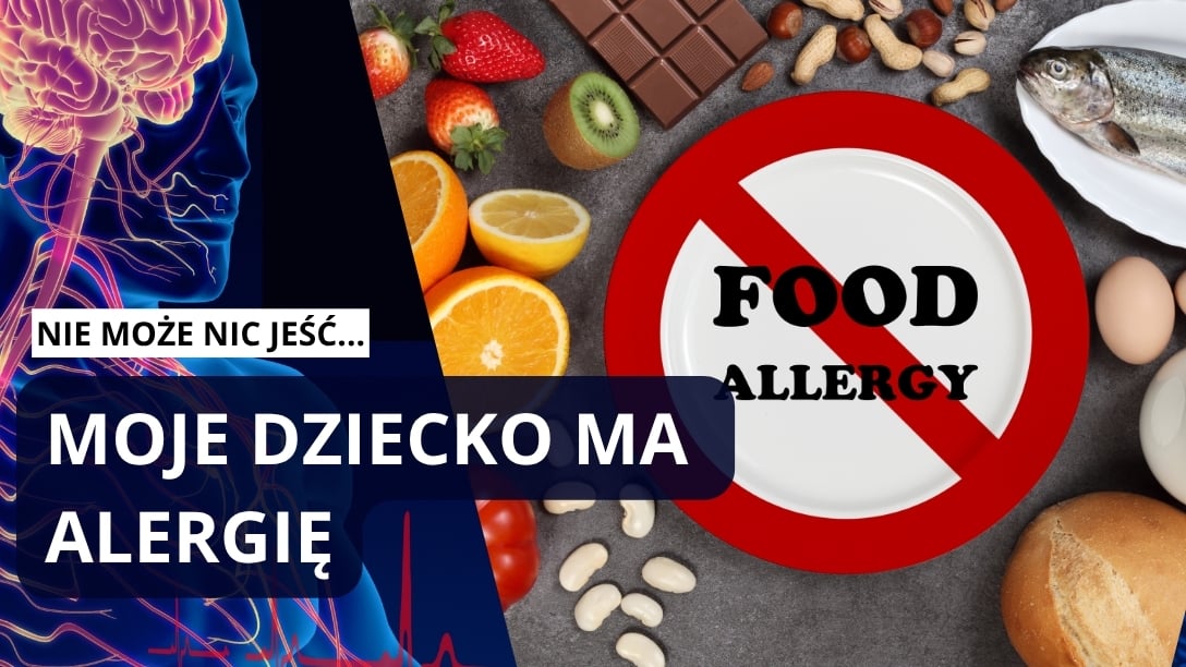 Myślisz, że dziecko ma alergię? Prof. Kulus ujawnia, kiedy rodzice się mylą