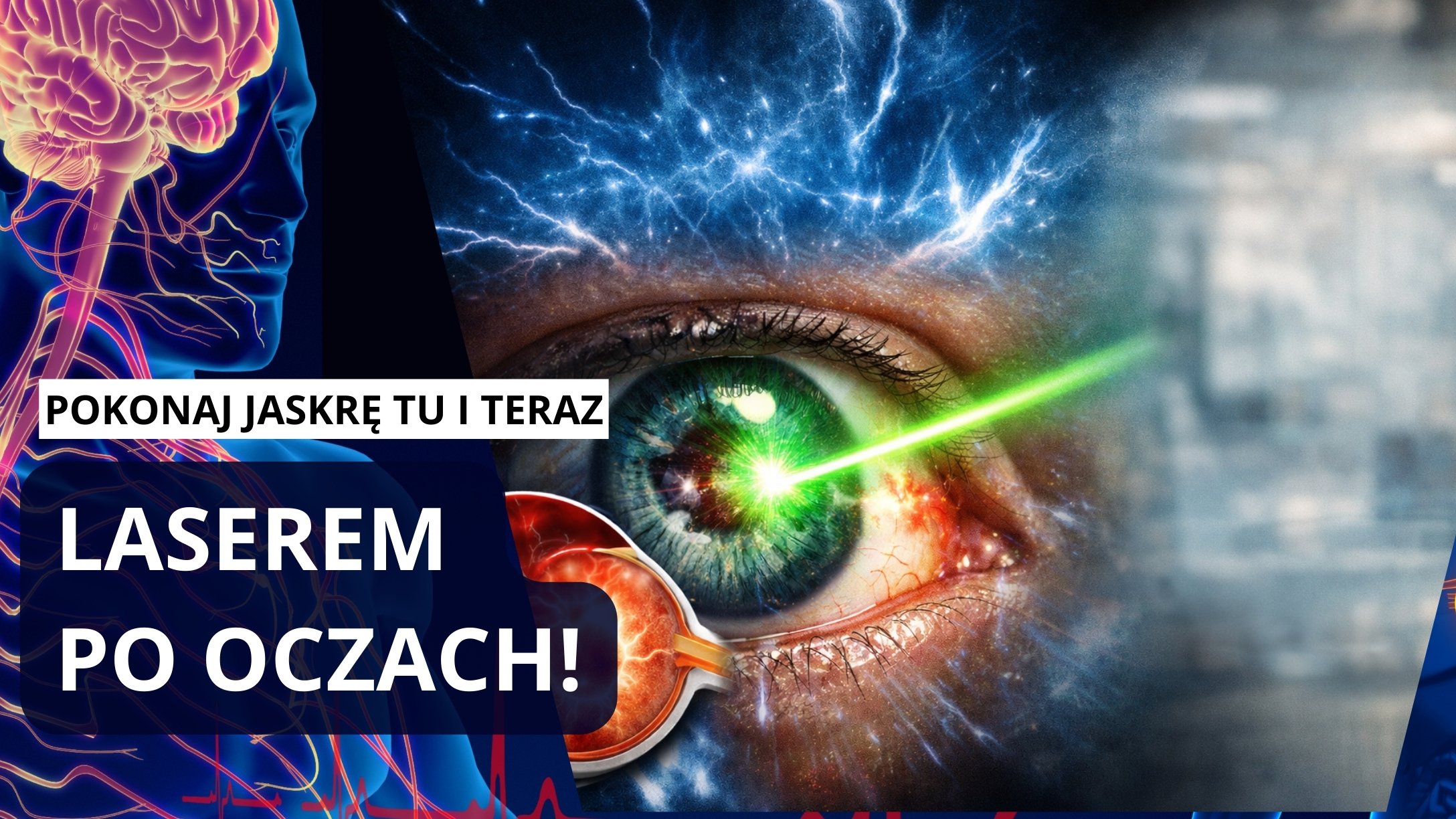 Jaskra zabiera wzrok milionom  Ten zabieg laserowy może to zmienić!