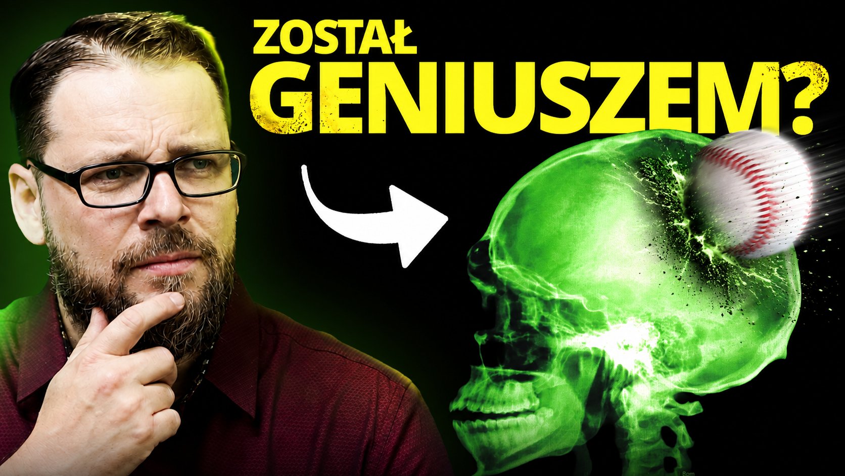 Zespół Sawanta