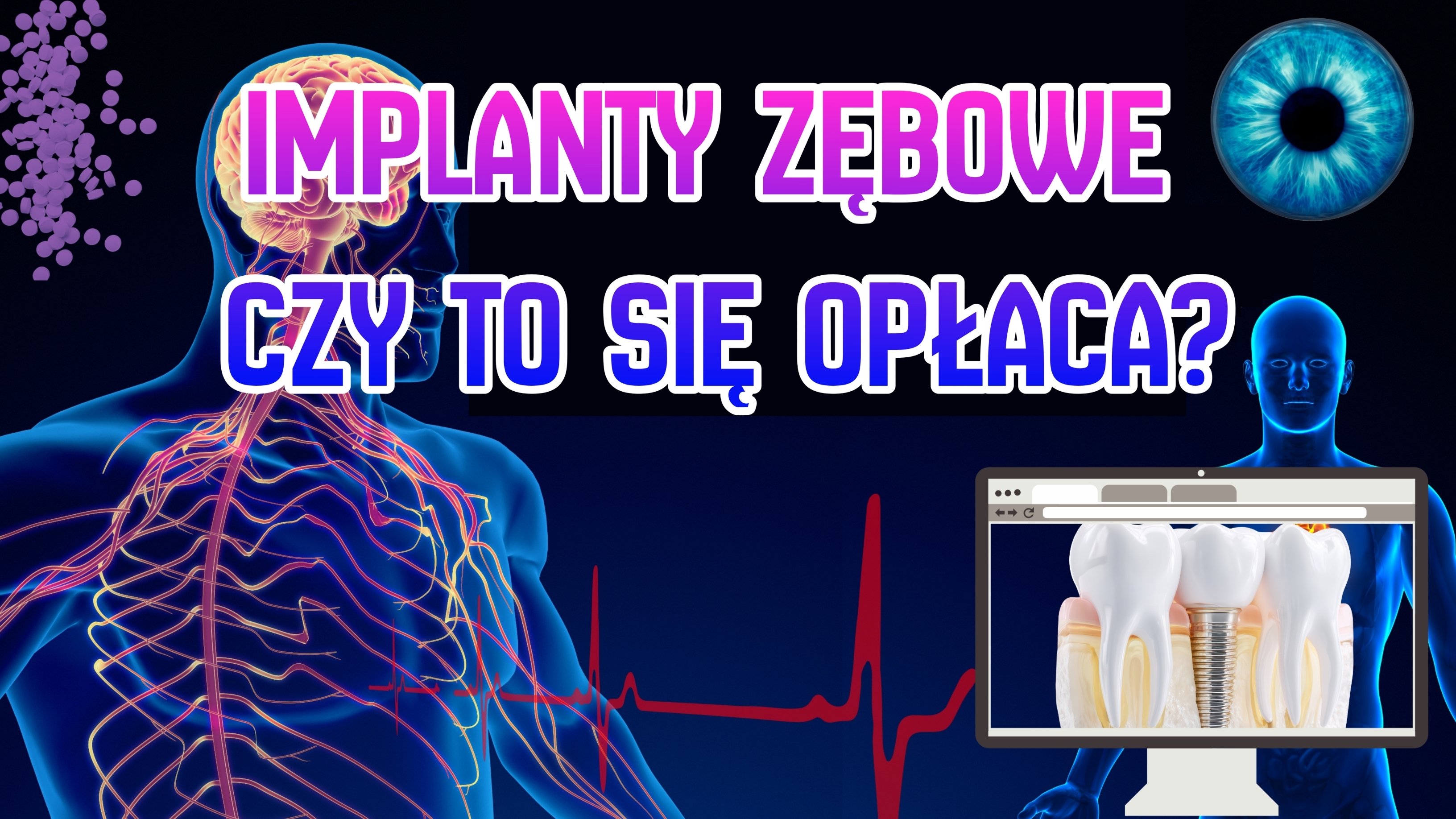 IMPLANTY ZĘBOWE – CZY TO SIĘ OPŁACA?